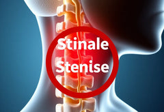 Ontsnap aan de pijn van spinale stenose in de nek: ontdek je opties nu