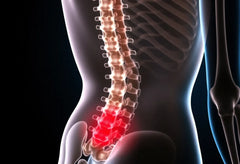 Gebochelde rug: ontdek hoe je je levenskwaliteit kunt verbeteren