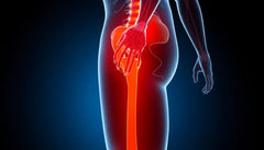 Zeg vaarwel tegen pijn in de bil en heup: ontdek verlichting en herstel!