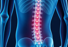 Bevrijd jezelf van lage rugpijn met uitstraling en voel je weer vrij