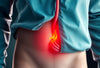 Ontdek de waarheid: kan een hernia terugkomen?