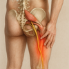 Ontdek Hoe Je Bilpijn Door piriformis syndrome Kunt Verzachten